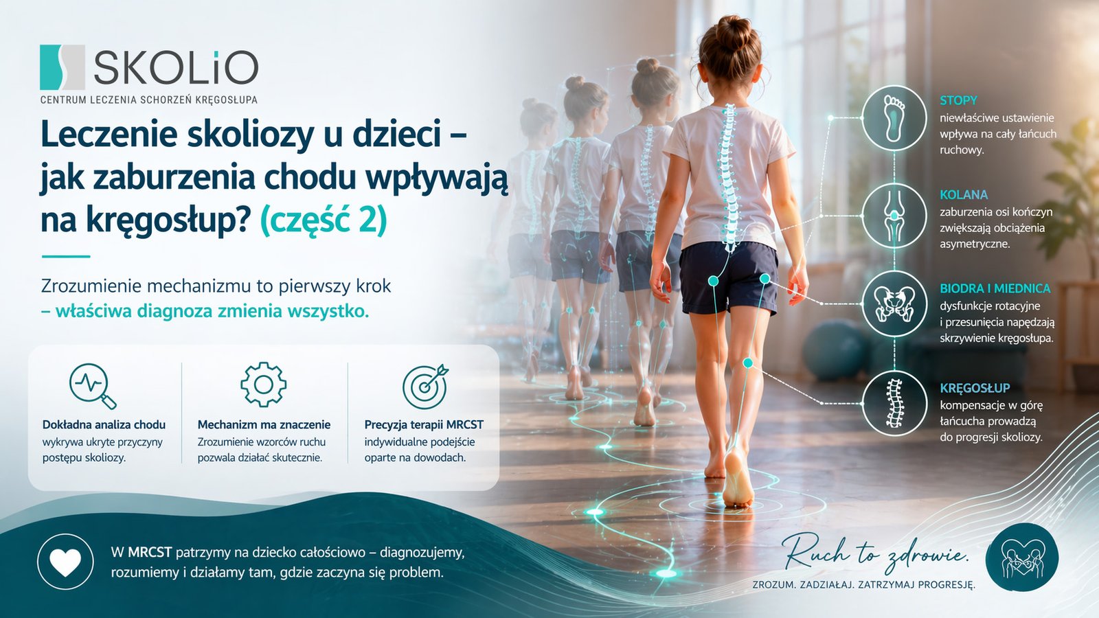 Skolioza u dzieci - kompletny przewodnik dla rodziców o wpływie zaburzeń chodu na kręgosłup (część 2)